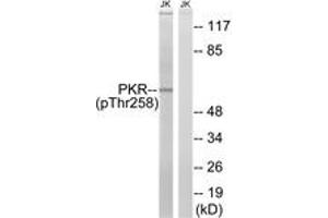 Western blot analysis of extracts from Jurkat cells treated with starved 24h, using PKR (Phospho-Thr258) Antibody. (EIF2AK2 Antikörper  (pThr258))