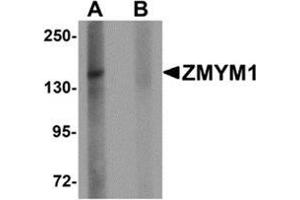 Western blot analysis of ZMYM1 in rat lung tissue lysate with ZMYM1 antibody at 1 μg/ml in (A) the absence and (B) the presence of blocking peptide. (ZMYM1 Antikörper  (C-Term))