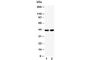 Western blot testing of BCAT1 antibody and Lane 1:  HeLa (BCAT1 Antikörper  (C-Term))