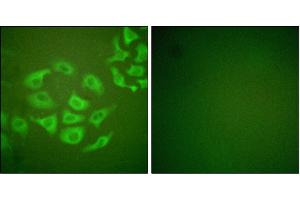 Iunofluorescence analysis of HepG2 cells, using P-10 antibody. (MMP10 Antikörper)