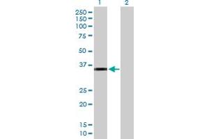 Western Blot analysis of CRHBP expression in transfected 293T cell line by CRHBP MaxPab polyclonal antibody. (CRHBP Antikörper  (AA 1-322))