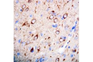 Anti-nNOS(neuronal) antibody, IHC(P) IHC(P): Rat Brain Tissue (NOS1 Antikörper  (C-Term))