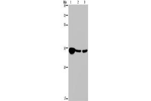 Western Blotting (WB) image for anti-Leucine Zipper Transcription Factor-Like 1 (LZTFL1) antibody (ABIN2430407) (LZTFL1 Antikörper)