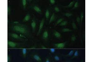 Immunofluorescence analysis of U-2 OS cells using CDKN1B Polyclonal Antibody at dilution of 1:100. (CDKN1B Antikörper)