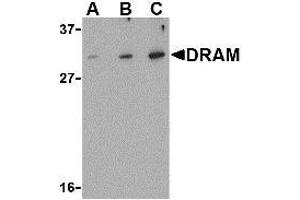 Western blot analysis of DRAM in K562 cell lysate with AP30305PU-N DRAM antibody at (A) 0. (DRAM Antikörper  (N-Term))