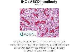 Image no. 1 for anti-ATP-Binding Cassette, Sub-Family D (Ald), Member 1 (ABCD1) antibody (ABIN1731416) (ABCD1 Antikörper)