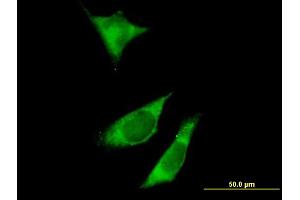 Immunofluorescence of purified MaxPab antibody to RPTOR on HeLa cell. (Raptor Antikörper  (AA 1-379))