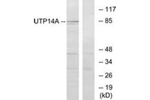 Western blot analysis of extracts from HeLa cells, using UTP14A Antibody. (UTP14A Antikörper  (AA 321-370))