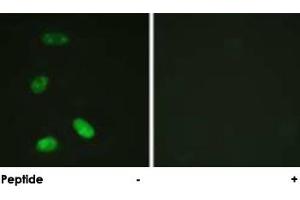 Immunofluorescence analysis of HeLa cells, using MYB polyclonal antibody . (MYB Antikörper  (Ser12))