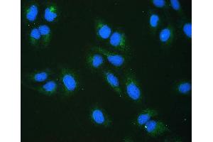 anti-Ribosome Binding Protein 1 (RRBP1) antibody
