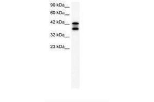 Image no. 2 for anti-Acetyl-CoA Acetyltransferase 2 (ACAT2) (AA 183-232) antibody (ABIN202425) (ACAT2 Antikörper  (AA 183-232))