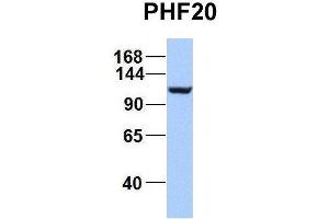 Host:  Rabbit  Target Name:  EGFL8  Sample Type:  Hela  Antibody Dilution:  1. (PHF20 Antikörper  (C-Term))