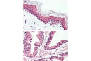 Immunohistochemical staining of human skin (A) and human prostate (B) with GPR126 polyclonal antibody . (G Protein-Coupled Receptor 126 Antikörper  (N-Term))