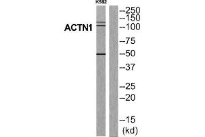 Western Blotting (WB) image for anti-Actinin, alpha 1 (ACTN1) (N-Term) antibody (ABIN1850167) (ACTN1 Antikörper  (N-Term))