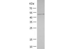 Western Blotting (WB) image for Protein Phosphatase 1F (PP2C Domain Containing) (PPM1F) (AA 1-454) protein (His tag) (ABIN7124670) (PPM1F Protein (AA 1-454) (His tag))