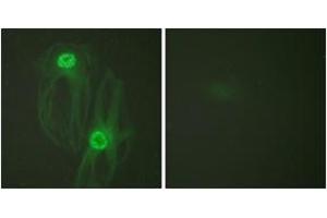 Immunofluorescence analysis of HeLa cells, using KIF11/Eg5 (Ab-927) Antibody.