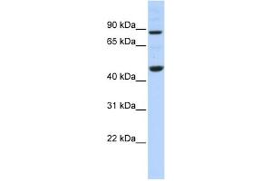 WB Suggested Anti-PPME1 Antibody Titration: 0. (PPME1 Antikörper  (N-Term))