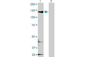 Western Blot analysis of CYFIP2 expression in transfected 293T cell line by CYFIP2 monoclonal antibody (M01), clone 4G6. (CYFIP2 Antikörper  (AA 733-820))