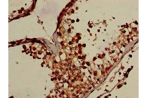 Immunohistochemistry (IHC) image for anti-Osteosarcoma Amplified 9, Endoplasmic Reticulum Lectin (OS9) (AA 232-413) antibody (ABIN7165899)