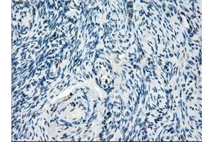 Immunohistochemical staining of paraffin-embedded colon tissue using anti-ZFP36 mouse monoclonal antibody. (ZFP36 Antikörper)