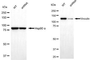 Western blotting analysis using Vinculin antibody (ABIN7800842).