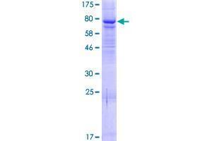 Image no. 1 for Elongator Acetyltransferase Complex Subunit 4 (ELP4) (AA 1-535) protein (GST tag) (ABIN1352730) (ELP4 Protein (AA 1-535) (GST tag))