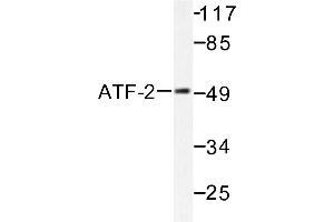 Image no. 1 for anti-Activating Transcription Factor 2 (ATF2) antibody (ABIN265320) (ATF2 Antikörper)