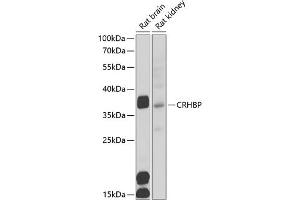 Western blot analysis of extracts of various cell lines, using CRHBP antibody (ABIN6129571, ABIN6139030, ABIN6139033 and ABIN6222243) at 1:1000 dilution. (CRHBP Antikörper  (AA 25-322))