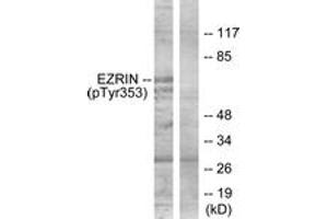 Western blot analysis of extracts from A431 cells treated with EGF 200ng/ml 30', using Ezrin (Phospho-Tyr353) Antibody. (Ezrin Antikörper  (pTyr354))