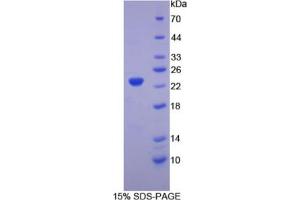 SDS-PAGE analysis of Chicken Hemoglobin beta Protein. (Hemoglobin Subunit beta Protein)