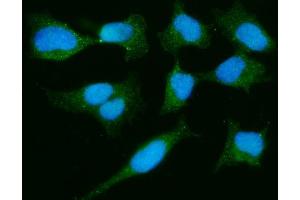 IF analysis of PARK7/DJ1 using anti-PARK7/DJ1 antibody (ABIN7600468). (PARK7/DJ1 Antikörper  (AA 2-189))