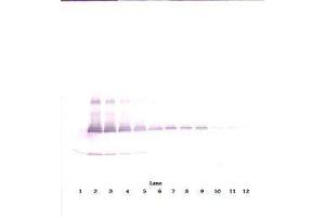 Image no. 3 for anti-Interleukin 17A (IL17A) antibody (ABIN465353) (Interleukin 17a Antikörper)