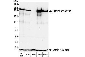 Western Blotting (WB) image for anti-AT Rich Interactive Domain 1A (SWI-Like) (ARID1A) (AA 750-800) antibody (ABIN7795678)