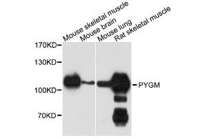 Western blot analysis of extracts of various cell lines, using PYGM antibody. (PYGM Antikörper  (C-Term))