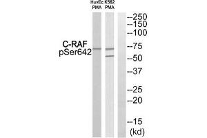 Western blot analysis of extracts from HuvEc cells and K562 cells treated with PMA using C-RAF (Phospho-Ser642) Antibody. (RAF1 Antikörper  (pSer642))