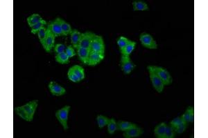 Immunofluorescence staining of HepG2 cells with ABIN7170083 at 1:166, counter-stained with DAPI. (KCC2 Antikörper  (AA 944-1071))