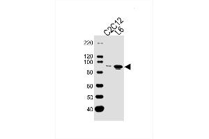 Lane 1: Mouse C2C12 Cell Lysates, Lane 2: Rat L6 Cell Lysates, probed with Musk (1429CT456. (MUSK Antikörper)