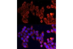 Immunofluorescence analysis of HeLa cells using MTOR antibody. (MTOR Antikörper)