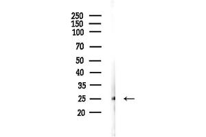 Western blot analysis of lysates from Mouse liver, using Phospho-FADD (Ser190) Antibody at 1/1000 dilution.