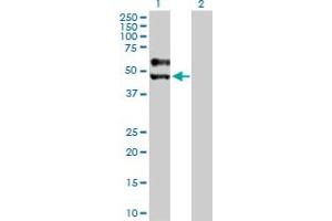 Western Blot analysis of SIGIRR expression in transfected 293T cell line by SIGIRR MaxPab polyclonal antibody. (SIGIRR Antikörper  (AA 1-410))