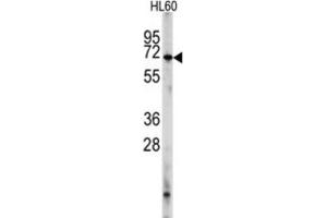 Western Blotting (WB) image for anti-phosphodiesterase 8A (PDE8A) antibody (ABIN2998130) (PDE8A Antikörper)