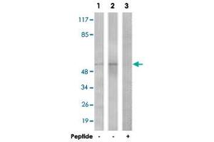 Western blot analysis of extracts from COLO cells (Lane 1) and HepG2 cells (Lane 2 and 3), using TGFBR1 polyclonal antibody . (TGFBR1 Antikörper  (Ser165))
