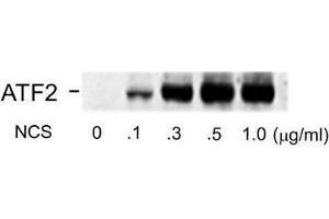 Image no. 1 for anti-Activating Transcription Factor 2 (ATF2) (pSer490), (pSer498) antibody (ABIN372591) (ATF2 Antikörper  (pSer490, pSer498))