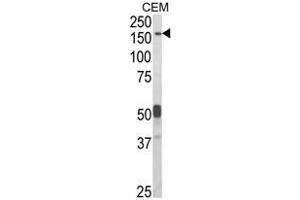 Western blot analysis of CNTNAP2 Antibody (Center) in CEM cell line lysates (35ug/lane). (CNTNAP2 Antikörper  (Middle Region))