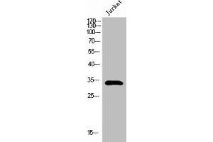 Western Blot analysis of Jurkat cells using Pitx1 Polyclonal Antibody (PITX1 Antikörper  (Internal Region))