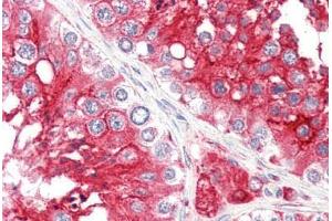 Human Testis (formalin-fixed, paraffin-embedded) stained with ACE2 antibody ABIN461888 at 2. (ACE2 Antikörper  (Internal Region))