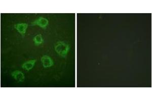 Immunofluorescence analysis of HuvEc cells, using KSR (Ab-392) Antibody.