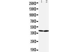 Anti-SLC10A1 antibody, Western blotting All lanes: Anti SLC10A1  at 0. (SLC10A1 Antikörper  (Middle Region))