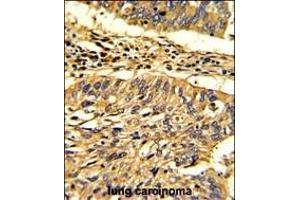 Immunohistochemistry (Paraffin-embedded Sections) (IHC (p)) image for anti-Heat Shock 60kDa Protein 1 (Chaperonin) (HSPD1) (AA 80-109), (N-Term) antibody (ABIN390772)