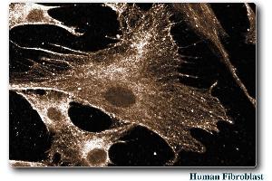Human Fibroblast (RAC1 Antikörper)